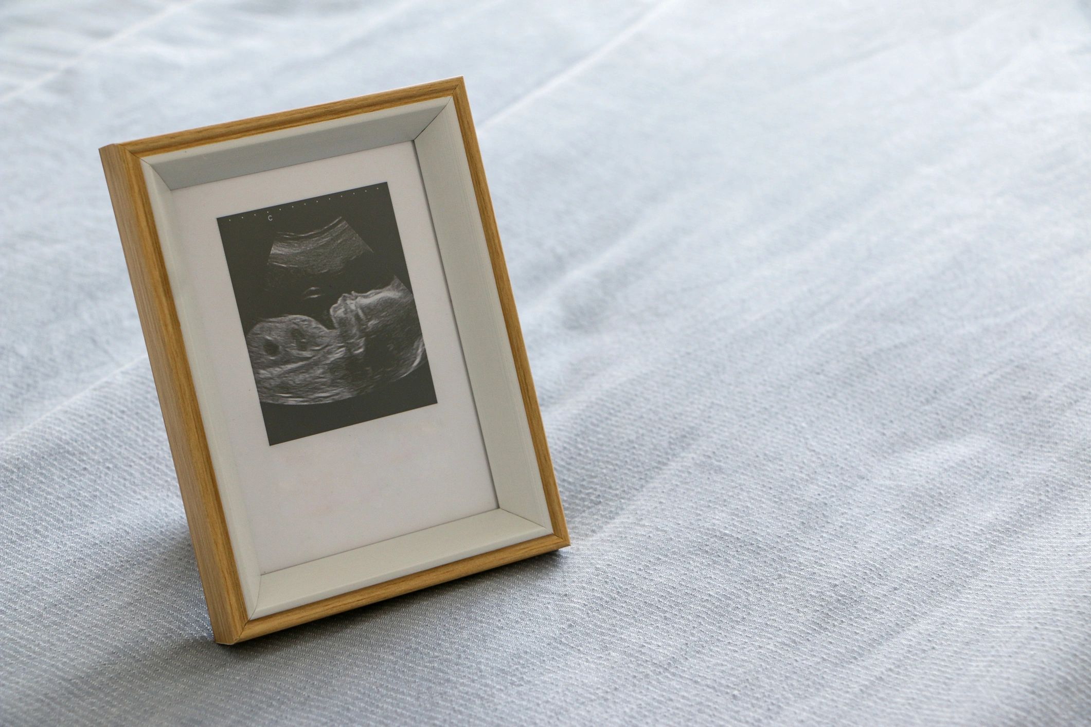 Framed ultrasound image displayed as a keepsake portrait