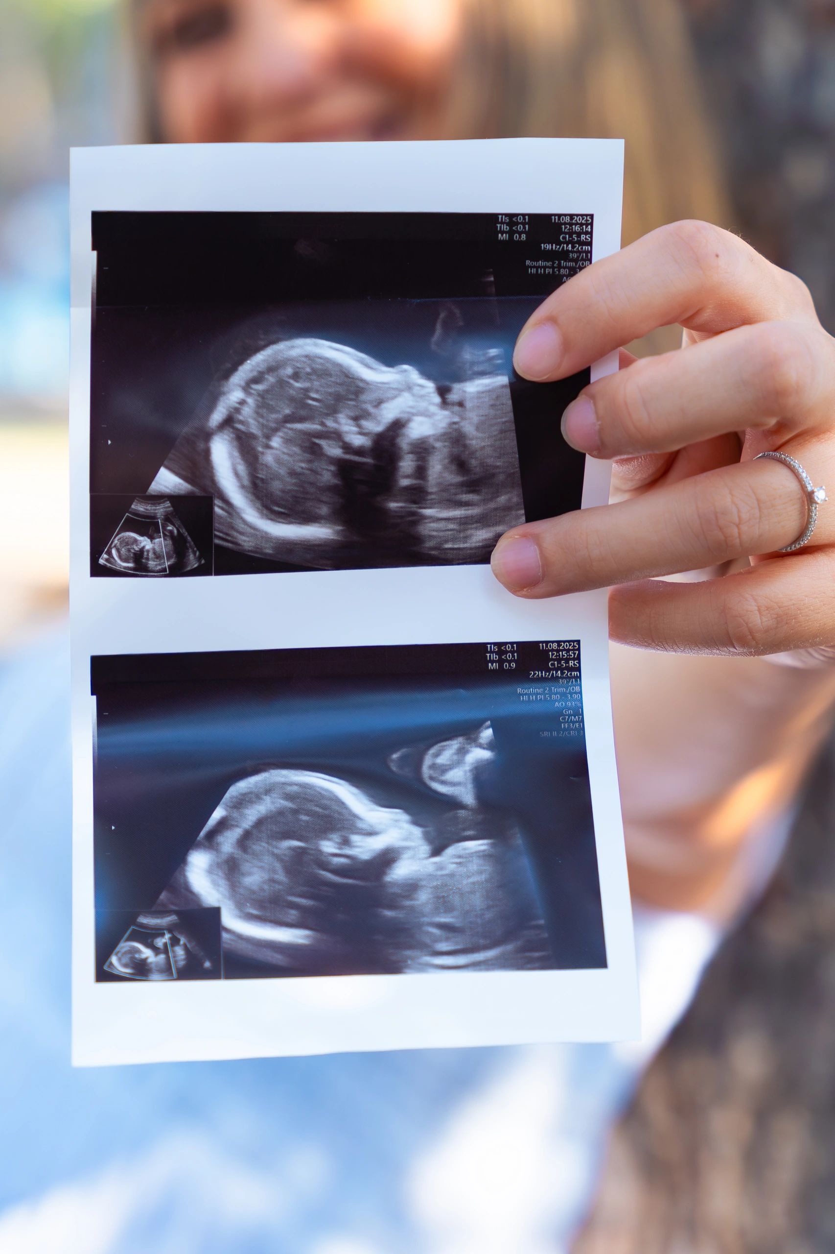 Pregnant mother with ultrasound photo
