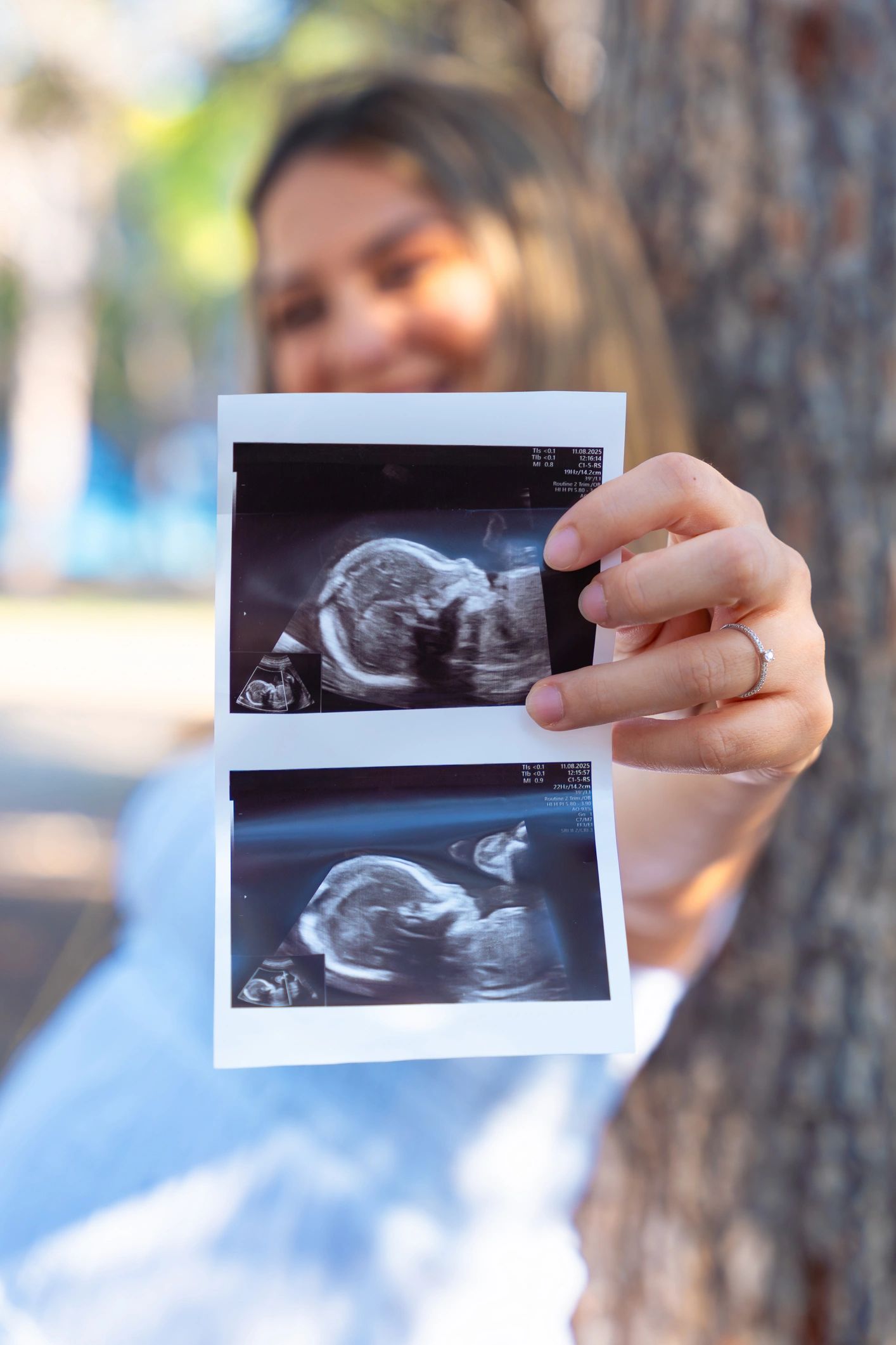 Expecting mother holding an ultrasound photo