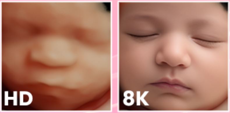 3d HD picture of prenatal baby and 5k baby ultrasound
