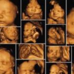 3d baby ultra sound pictures 